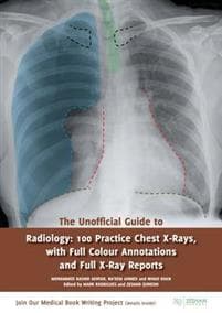 The Unofficial Guide to Radiology 100 Practice Chest X Rays with Full