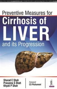 Prevention Measures for Cirrhosis of Liver and its Progression Khyati