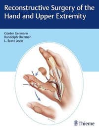 Reconstructive Surgery of the Hand and Upper Extremity Günter Germann