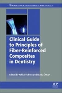 Clinical Guide to Principles of Fiber-Reinforced Composites in Dentistry