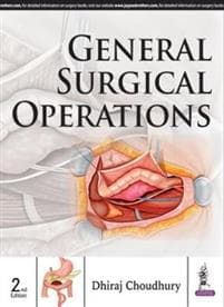 General Surgical Operations