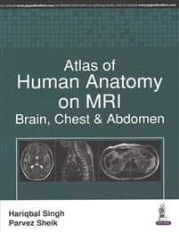 Atlas of Human Anatomy on MRI