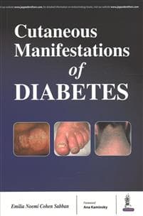 Cutaneous Manifestations of Diabetes