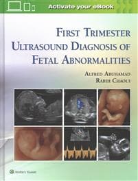 First Trimester Ultrasound Diagnosis of Fetal Abnormalities Alfred Z