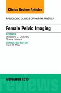 Female Pelvic Imaging, An Issue of Radiologic Clinics of North America