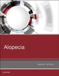 Alopecia