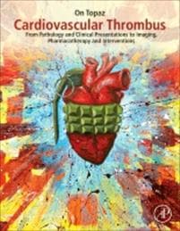 Cardiovascular Thrombus