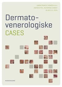 Dermato- venerologiske cases