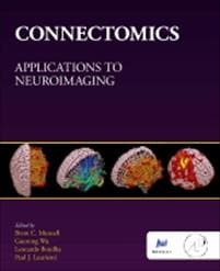 Connectomics