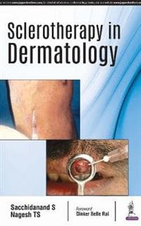 Sclerotherapy in Dermatology