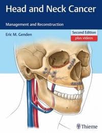 Head and Neck Cancer