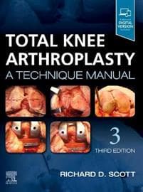 Total Knee Arthroplasty
