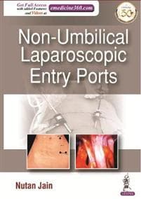 Non-Umbilical Laparoscopic Entry Ports