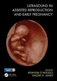 Ultrasound in Assisted Reproduction and Early Pregnancy