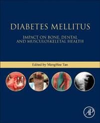 Diabetes Mellitus
