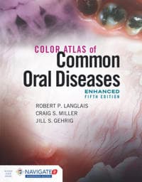 Color Atlas of Common Oral Diseases, Enhanced Edition