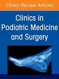 Cavus Foot Deformity, An Issue of Clinics in Podiatric Medicine and Surgery