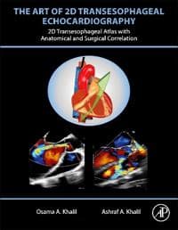 The Art of 2D Transesophageal Echocardiography