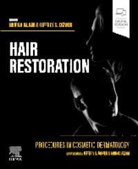 Procedures in Cosmetic Dermatology: Hair Restoration