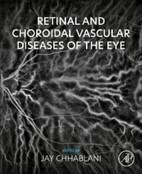 Retinal and Choroidal Vascular Diseases of the Eye