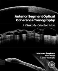 Anterior Segment Optical Coherence Tomography