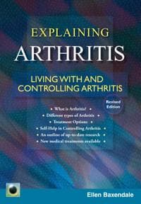 An Emerald Guide to Explaining Arthritis