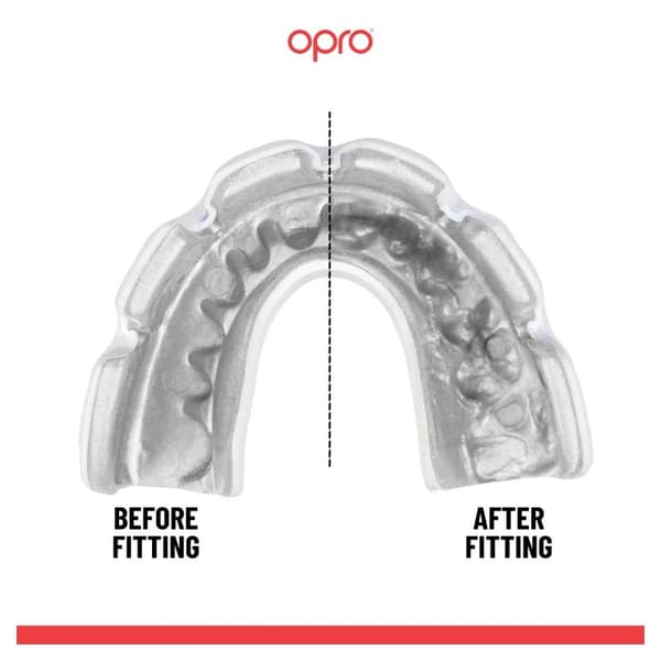 Opro Custom Fit tandbøjle Tandbeskytter Sort/Hvid