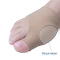 Miniatyrbild 2 av 2: Tryckavlastning Hallux Valgus