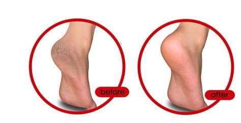 Spa Gelsocka