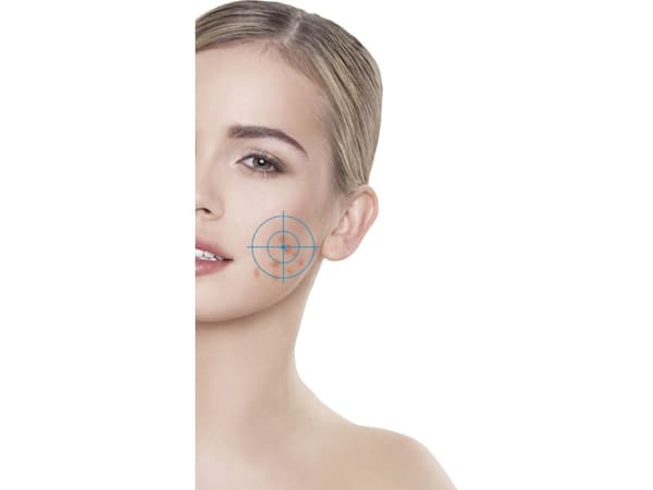 Rio Q-Acne Lite3 ansiktsrengöring
