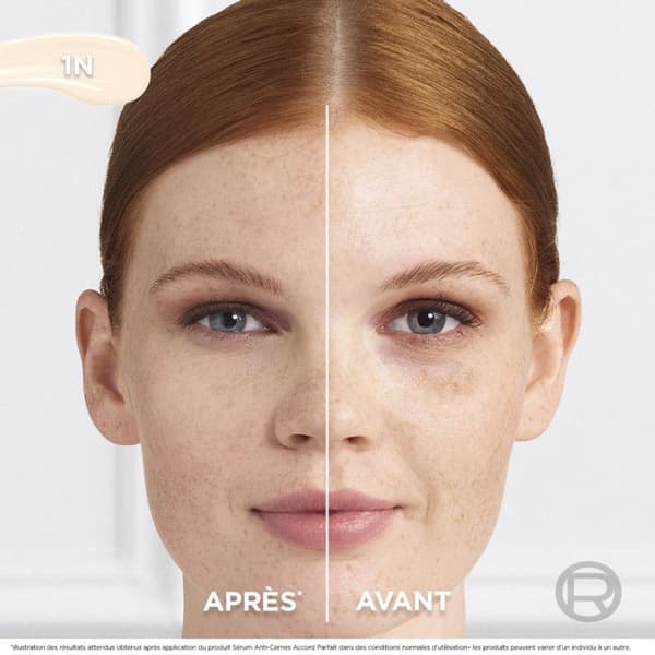 L'Oréal Paris Serum Anti-Cernes Accord Parfait 1N 11ml