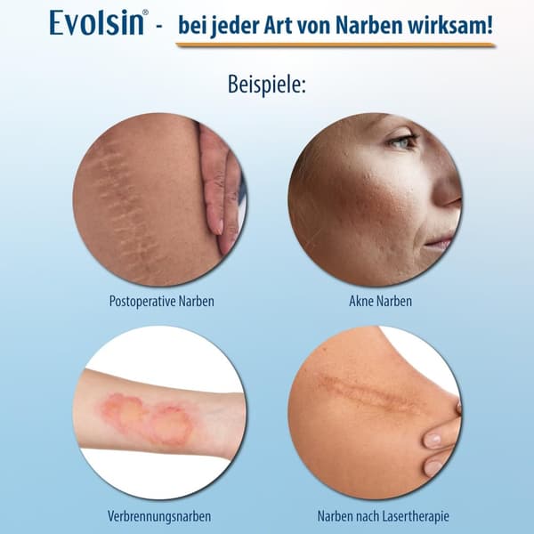 INF Arrtape - Silikonarrark Matt gjennomsiktig farge 1.5m