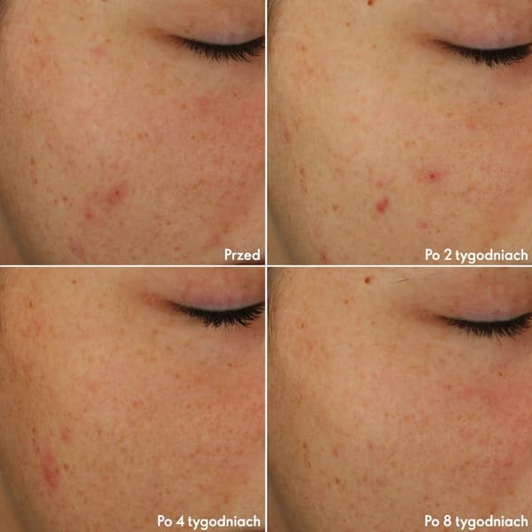 Oriflame Set Novage+ Blemish + Age Defy Light Formulas 5 st.