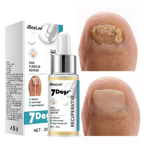 7DAYS Reparation Nail Fungus Treatments Essence Foot Care Serum