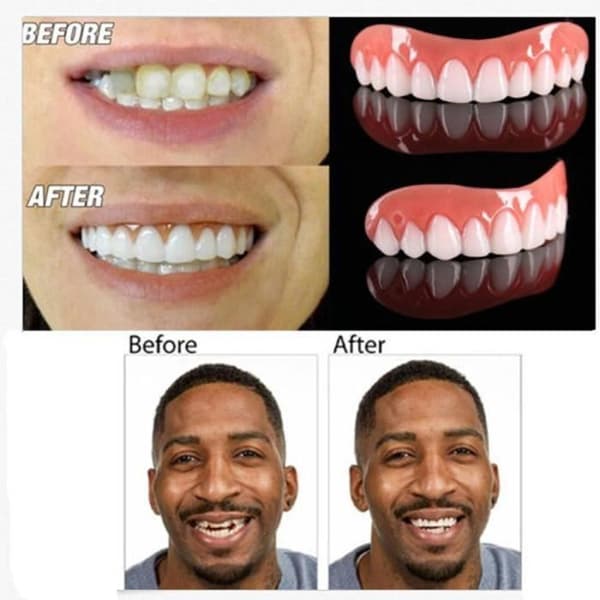 1 st Silikon Män Kvinnor Perfect Smile Faner Protespasta Omedelbar Tänder Flex
