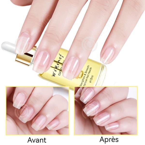 INN Nail Cuticle Oil 1 set med 4 delar Finger Oil Nagelvårdsolja Mjuka upp död hud Återfukta naglar