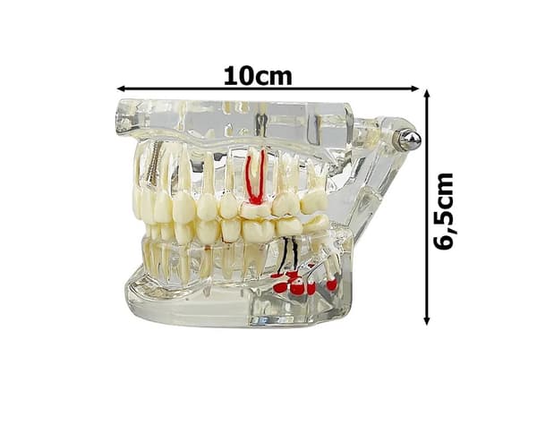 Anatomisk Tandmodell - Tandprotes