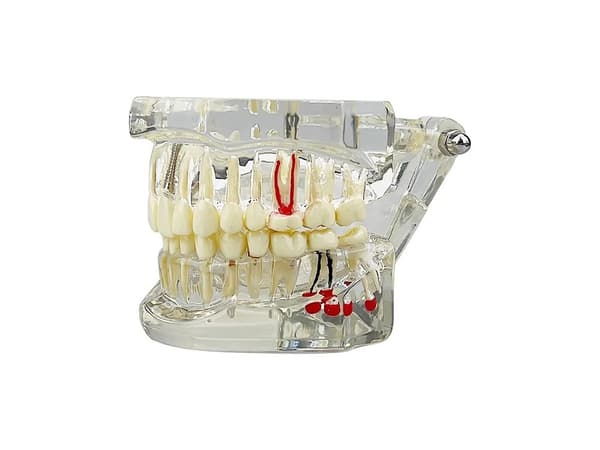 Anatomisk Tandmodell - Tandprotes