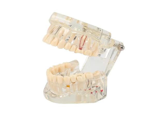 Anatomisk Tandmodell - Tandprotes