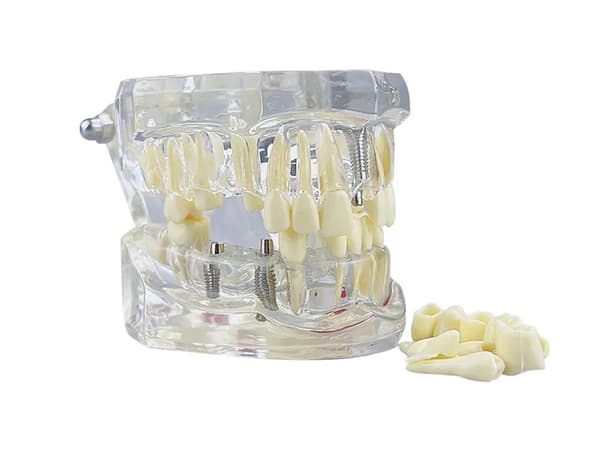 Anatomisk Tandmodell - Tandprotes