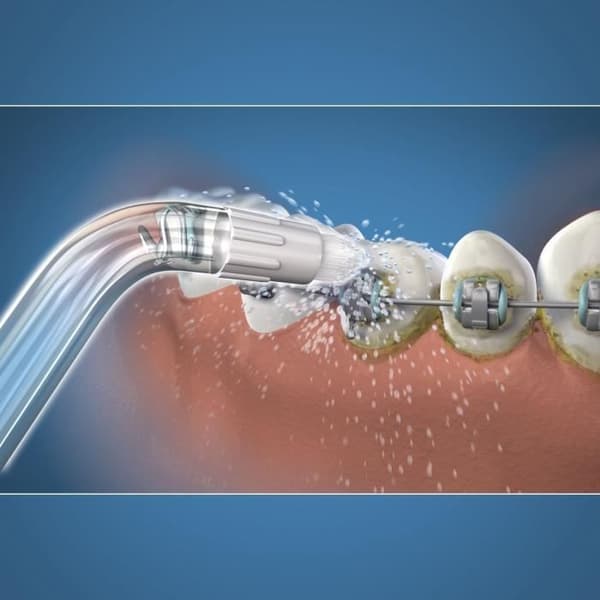 Vattentrådsspets - WATERPIK - Ortodontisk - Eliminerar plack - Special dentala apparater