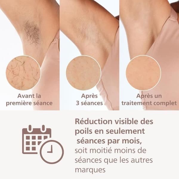 IPL-laser epilator Philips Lumea Serie 8000