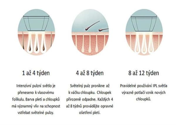 Epilator IPL Smart BR-1520