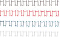 Miniatyrbild 11 av 11: Wire back 12,7 mm 34 ringar A4 GBC Black Pack med 100 stycken