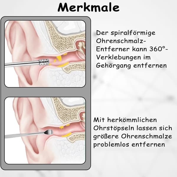 6st Öronplockningsset - Enkel Vaxrengöring
