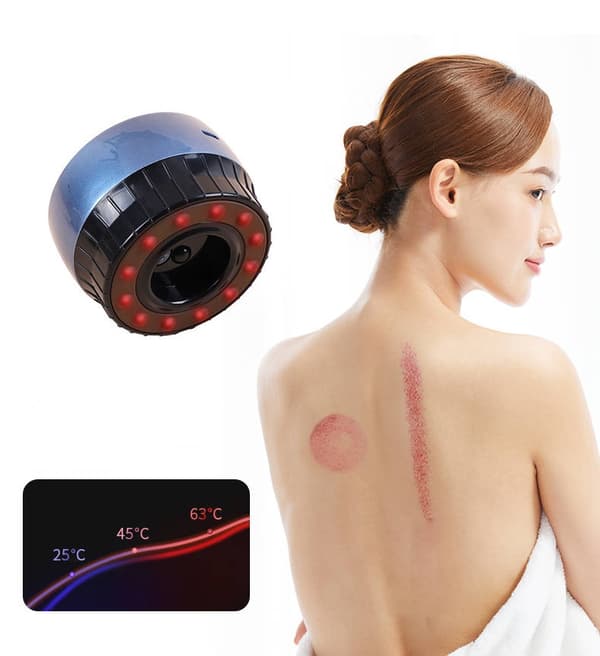 Elektronisk Massageapparat för Koppningsterapi - Laddningsbar
