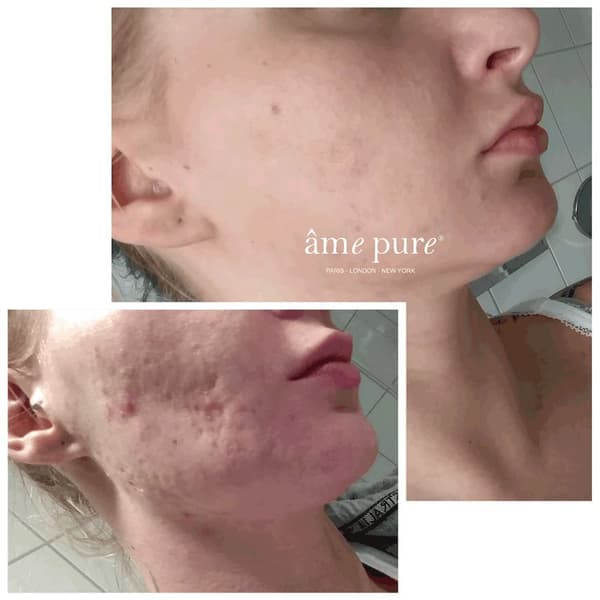 ame pure CIT Face Roller PLATINUM