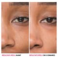 Miniatyrbild 3 av 4: IT Cosmetics Ansiktsvårdserum Bye Bye Pores Anti-Visible Pore Serum med glykolsyra 30ml