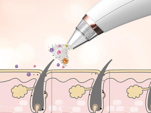 Poreormsug / Blackhead remover