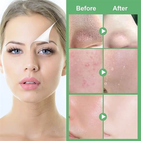 Green Tea Mask Stick - Fjern hudormer med grønn te-ekstrakt